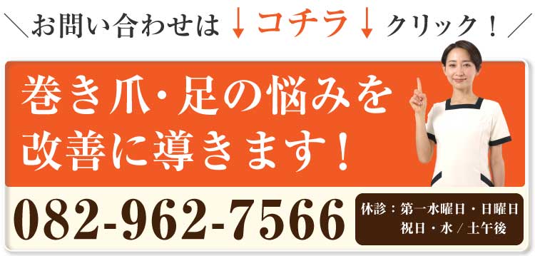 巻き爪フットケア大町東院,巻き爪,広島,安佐南区,大町東,陥入爪